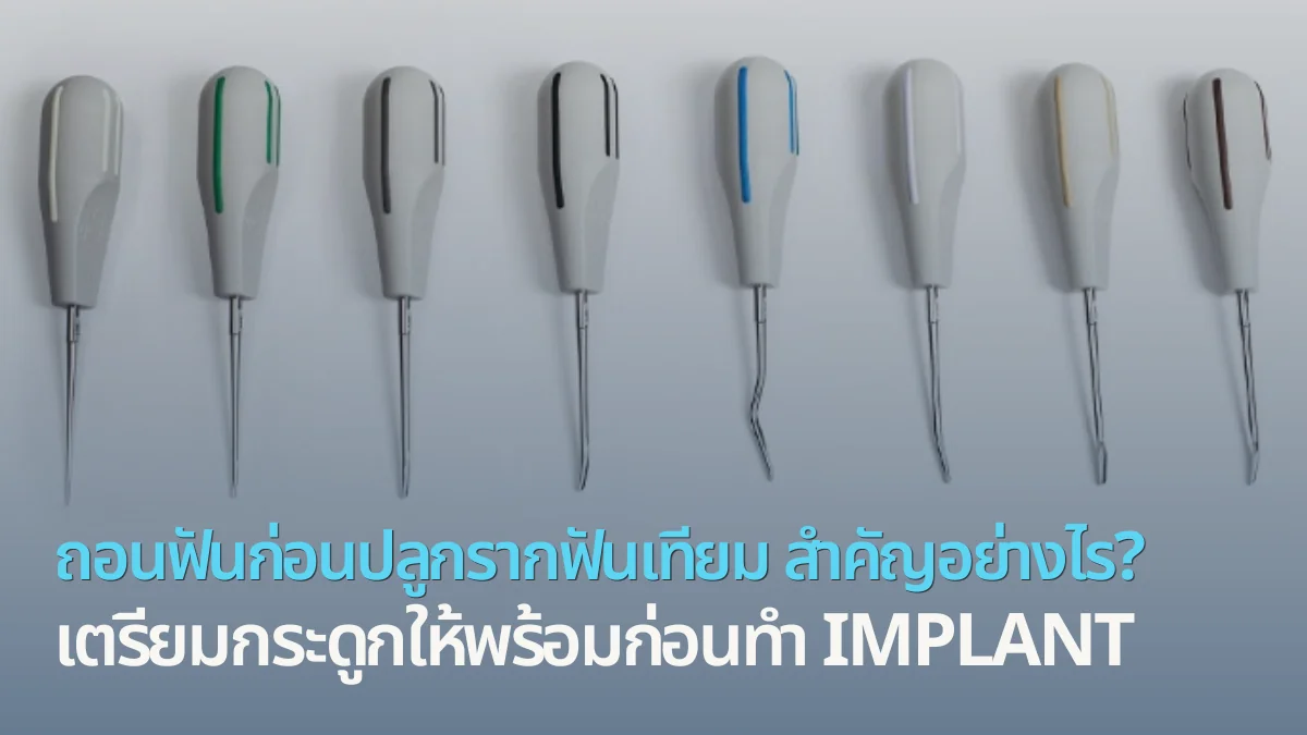 ถอนฟันก่อนปลูกรากฟันเทียม